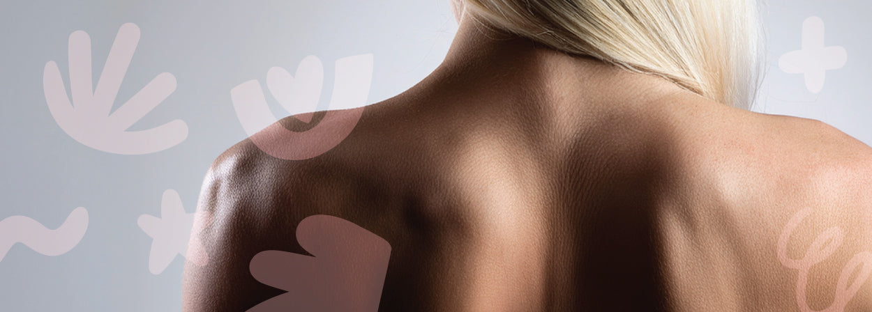 Backne (Sırt Aknesi)